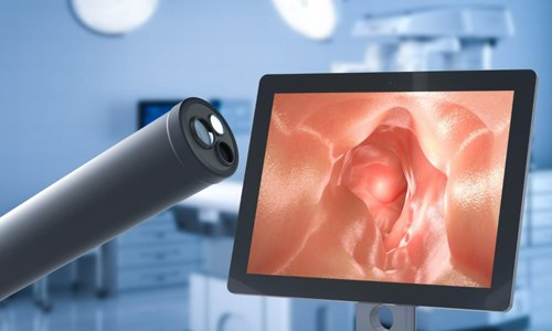 EGD – Upper Gastrointestinal (GI) Endoscopy